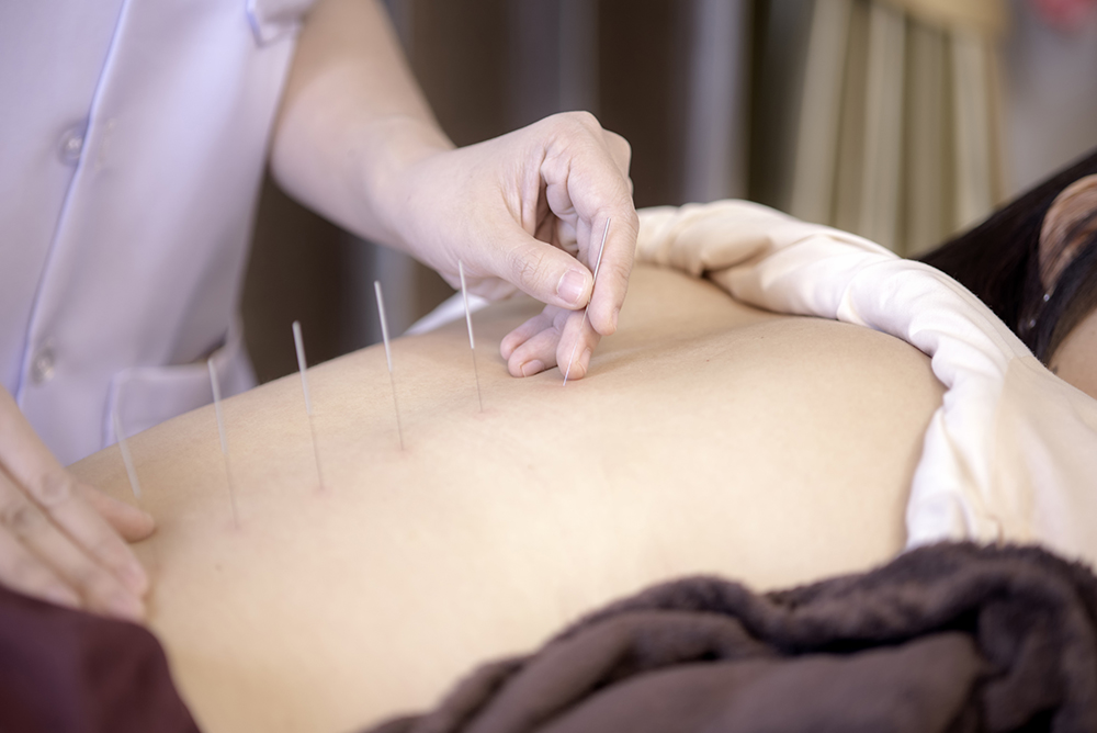 Entenda as diferenças entre shiatsu e acupuntura » Ortopedia Daniachi